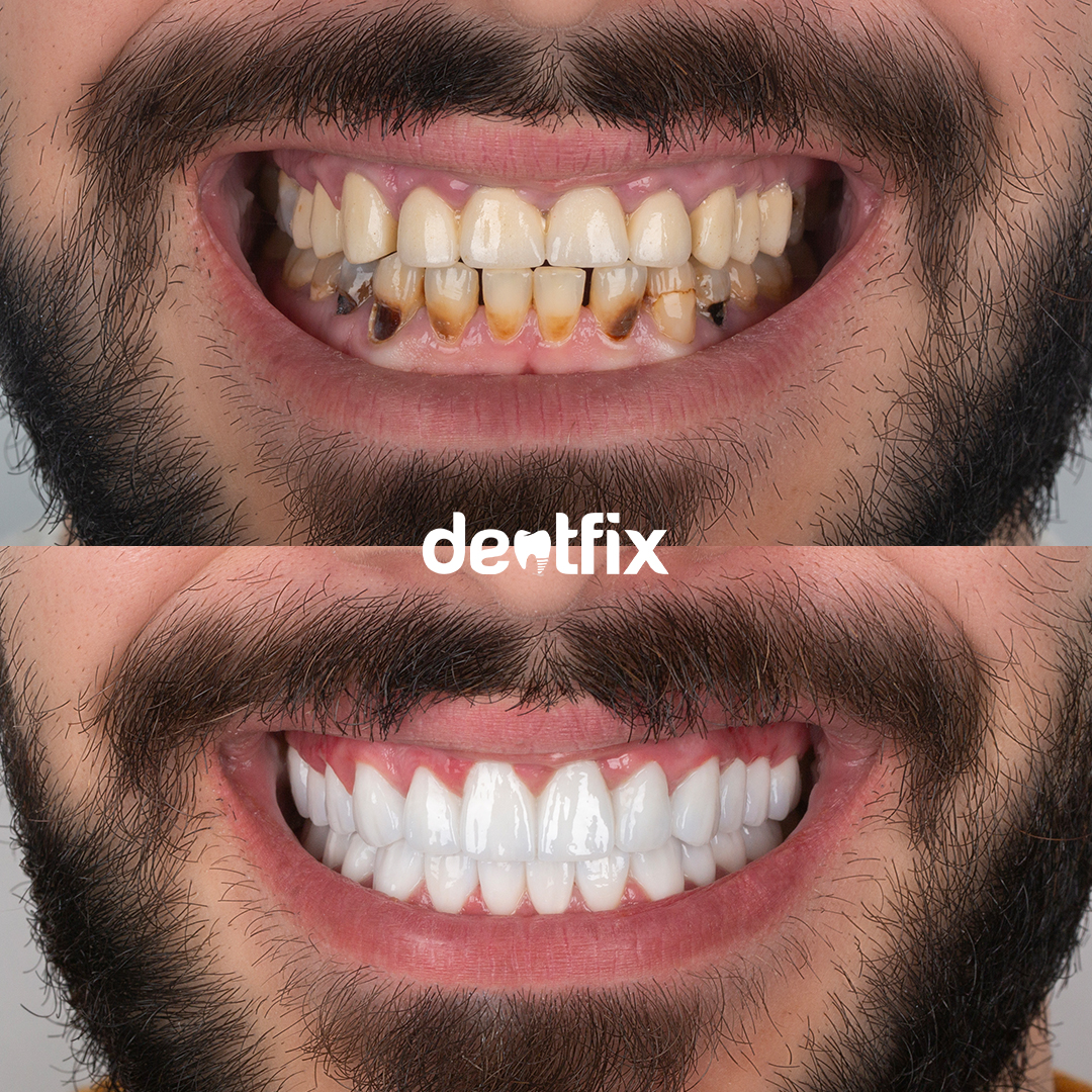 before & after